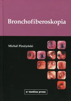 Bronchofiberoskopia - Michał Pirożyński