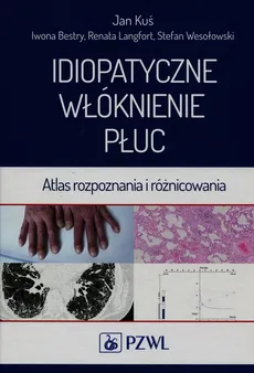Idiopatyczne włóknienie płuc - Outlet - Iwona Bestry, Jan Kuś, Renata Langfort