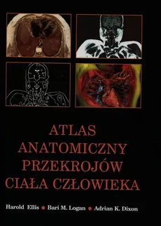 Atlas anatomiczny przekrojów ciała człowieka - Outlet - Dixon Adrian K., Harold Ellis, Logan Bari M.