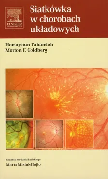 Siatkówka w chorobach układowych - Outlet - Goldberg Morton F., Homayoun Tabandeh