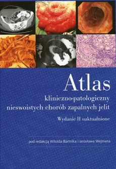 Atlas kliniczno-patologiczny nieswoistych chorób zapalnych jelit - Outlet