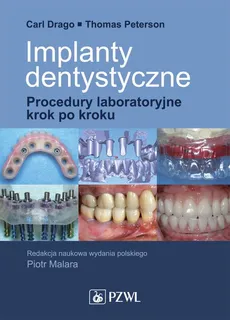 Implanty dentystyczne. Procedury laboratoryjne krok po kroku - Carl Drago, Thomas Peterson