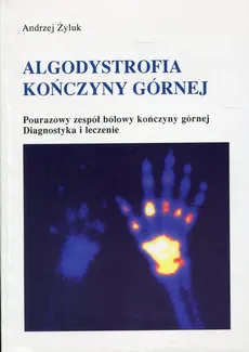 Algodystrofia kończyny górnej - Andrzej Żyluk