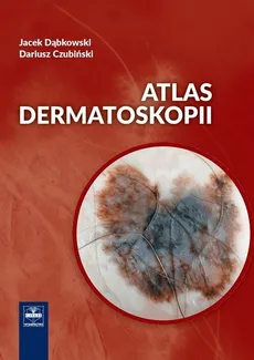 Atlas dermatoskopii - Dariusz Czubiński, Jacek Dąbkowski
