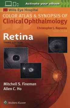 Retina - Mitchell Fineman