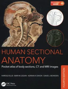 Human Sectional Anatomy - Dixon Adrian K., Harold Ellis, Logan Bari M.