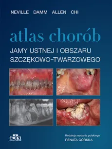 Atlas chorób jamy ustnej i obszaru szczękowo-twarzowego - Outlet - C.M. Allen, Chi  A.C., D.D Damm, Neville  B.W.