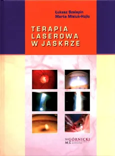 Terapia laserowa w jaskrze - Marta Misiuk-Hojło, Łukasz Szelepin