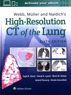 Webb, Müller and Naidich's High-Resolution CT of the Lung Sixth edition - Outlet - Sujal Desai, Devaraj  Anand, Elicker Brett M, David Lynch, Nicola Sverzellati