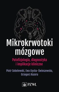 Mikrokrwotoki mózgowe - Grzegorz Kozera, Iżycka-Świeszewska Ewa, Sobolewski Piotr