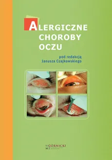 Alergiczne choroby oczu - Outlet - Ewa Bogacka, Janusz Czajkowski, Józef Małolepszy