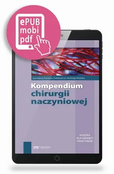 Kompendium chirurgii naczyniowej - Andrzej Wojtak, Tomasz Zubilewicz