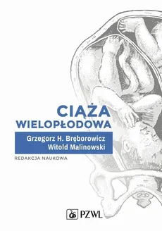 Ciąża wielopłodowa - Bręborowicz Grzegorz H., Witold Malinowski