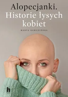 Alopecjanki - Marta Kawczyńska