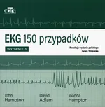 EKG 150 przypadków - Adlam D.