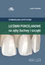 Licówki porcelanowe na zęby żuchwy i szczęki - J. Ciesielski