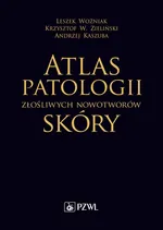 Atlas patologii złośliwych nowotworów skóry - Andrzej Kaszuba