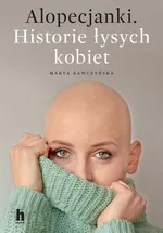 Alopecjanki - Marta Kawczyńska