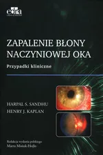 Zapalenie błony naczyniowej oka - H.J. Kaplan