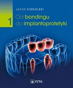 Od bondingu do implantoprotetyki Część 1 - Jacek Ciesielski