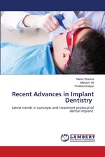 Recent Advances in Implant Dentistry - Mansi Sharma