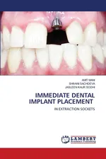 IMMEDIATE DENTAL IMPLANT PLACEMENT - AMIT MANI
