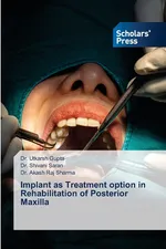 Implant as Treatment option in Rehabilitation of Posterior Maxilla - Dr. Utkarsh Gupta