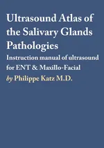 Ultrasound Atlas of the Salivary Glands Pathologies - Philippe Katz M.D.
