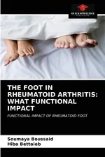THE FOOT IN RHEUMATOID ARTHRITIS - Soumaya Boussaid