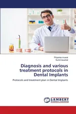 Diagnosis and various treatment protocols in Dental Implants - Priyanka muwal