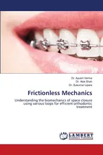 Frictionless Mechanics - Dr. Ayushi Verma