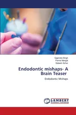 Endodontic mishaps- A Brain Teaser - Gajendra Singh