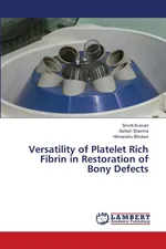 Versatility of Platelet Rich Fibrin in Restoration of Bony Defects - Smriti Kumari