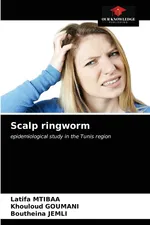 Scalp ringworm - Latifa Mtibaa