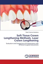 Soft Tissue Crown Lengthening Methods. Laser Crown Lengthening - Rada Torezova Kazakova