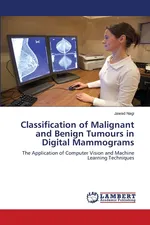 Classification of Malignant and Benign Tumours in Digital Mammograms - Jawad Nagi