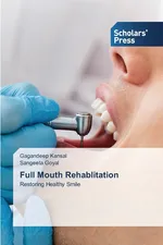 Full Mouth Rehablitation - Gagandeep Kansal