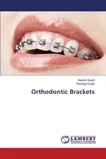 Orthodontic Brackets - Hanish Anand