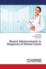 Recent Advancements in Diagnosis of Dental Caries - Aarti Garg