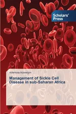 Management of Sickle Cell Disease in sub-Saharan Africa - Ademola Adewoyin