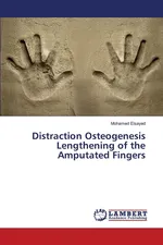 Distraction Osteogenesis Lengthening of the Amputated Fingers - Mohamed Elsayed