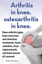 Arthritis in knee, osteoarthritis in knee. Knee arthritis types, knee exercises and stretches, treatments, home remedies, knee replacements and knee braces all covered. - Robert Rymore
