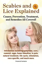 Scabies and Lice Explained. Causes, Prevention, Treatment, and Remedies All Covered! Information Including Symptoms, Removal, Eggs, Home Remedies, in - Frederick Earlstein