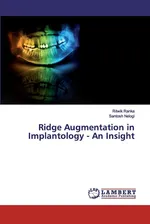 Ridge Augmentation in Implantology - An Insight - Ritwik Ranka