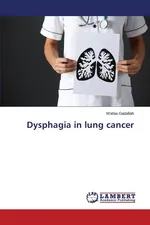 Dysphagia in lung cancer - Wafaa Gadallah