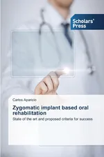 Zygomatic implant based oral rehabilitation - Carlos Aparicio