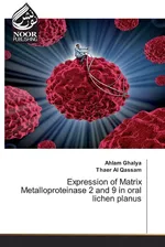 Expression of Matrix Metalloproteinase 2 and 9 in oral lichen planus - Ahlam Ghalya