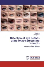Detection of eye defects using image processing concepts - Deepa D