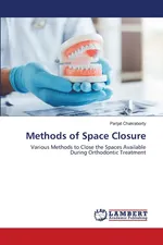 Methods of Space Closure - Parijat Chakraborty