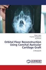Orbital Floor Reconstruction Using Conchal Auricular Cartilage Graft - Ritesh Vatsa